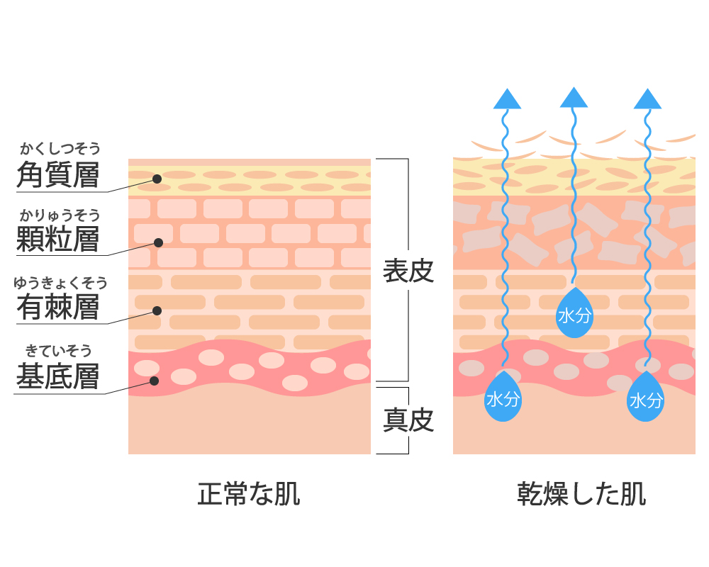 ダメージを受けやすいお肌